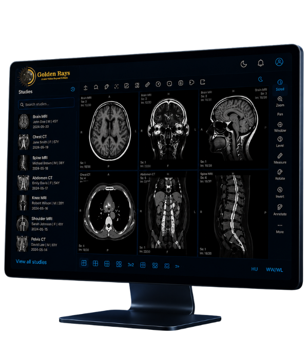 Goldenrays Teleradiology